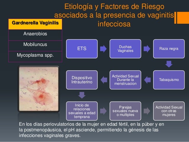 etiologia bartolinitis
